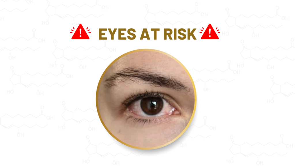 Side effects of prostaglandins in eyebrow serums